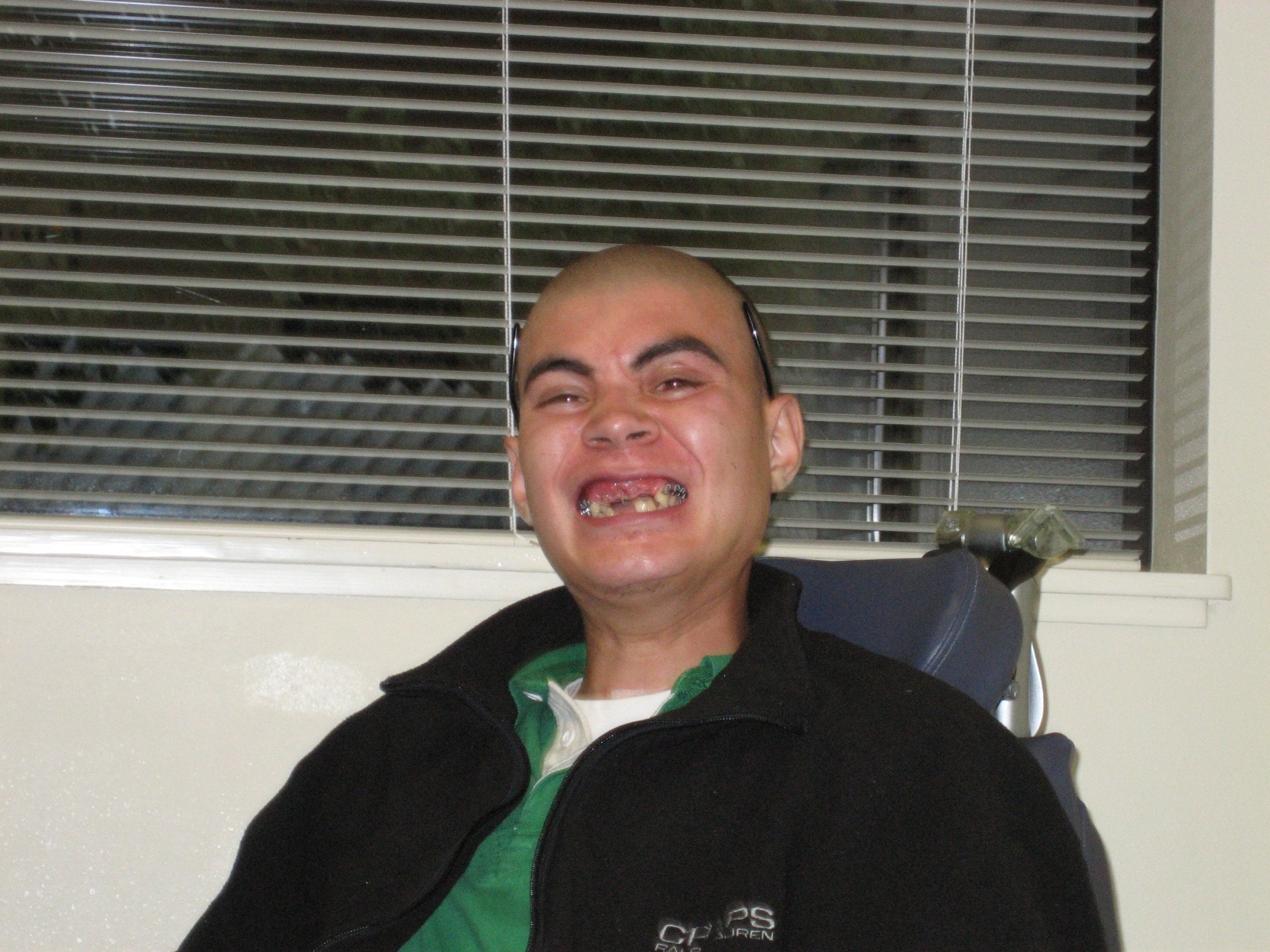 AOMS patient Arturo