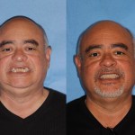 Before & After Dental Implants in Medford OR 